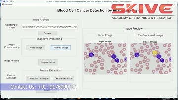 Analysis of Blood Samples for Counting Leukemia Cells Using Support Vector Machine  | Matlab Project