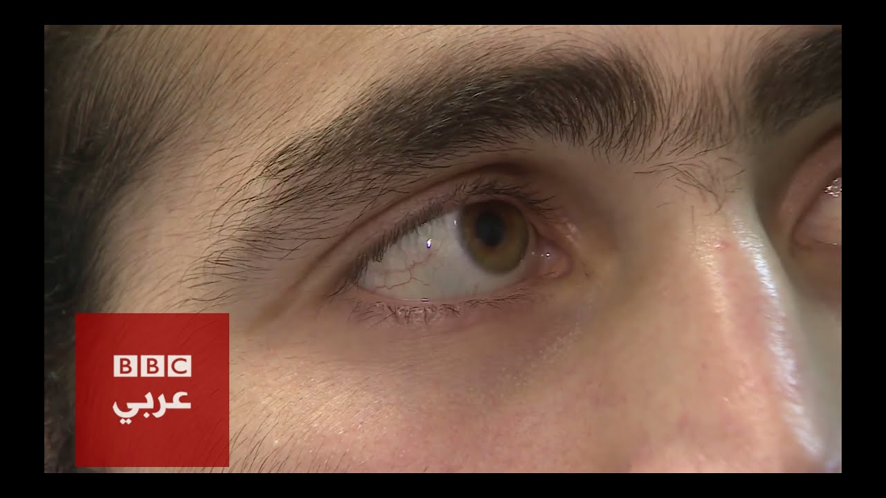 ١٥٠٠ جريح سوري يتلقون العلاج في إسرائيل