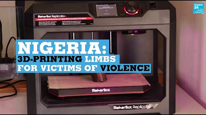 Nigeria: 3D-printing limbs for amputees
