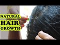 KNOW THE BEST NATURAL REMEDIES FOR HAIR GROWTH AND HAIR LOSS | REGROW HAIR NATURALLY IN 3 WEEKS