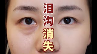 【Cissce崔崔】眼周遮瑕干货！徒手磨皮消除泪沟黑眼圈