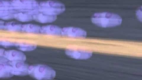 Why Cleanse Mercury Causes Brain Neuron Damage   Call Linda