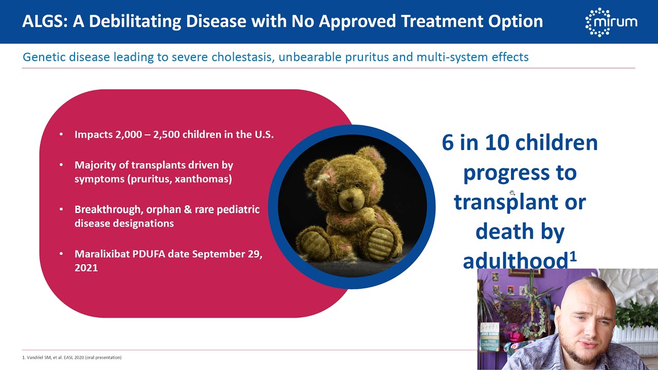 Do not buy Mirum Pharmaceuticals stock before seeing this video!📈 (MIRM Stock Analysis)
