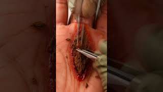 Extreme macro close-up inside a lumberjack's palm. brushed titanium micro-serrated tweezers held by