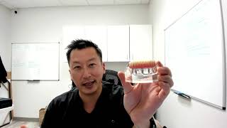 The Complete Guide to AllonFour Dental Implants