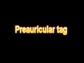 What Is The Definition Of  Preauricular tag Medical School Terminology Dictionary