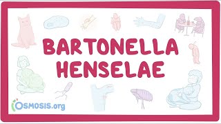 Bartonella henselae  an Osmosis Preview