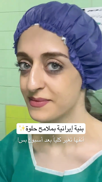 قبل وبعد عملية تجميل الأنف لبنية إيرانية حلوة 😍 فرق كبيـر من أول أسبوع بس!