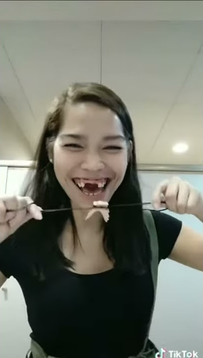 #Lucu..Awek Cun kantoi..Buat Tik Tok..Gigi tercabut..