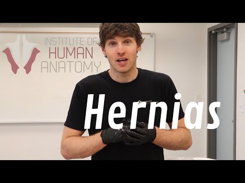 Video: Waar zijn hernia?