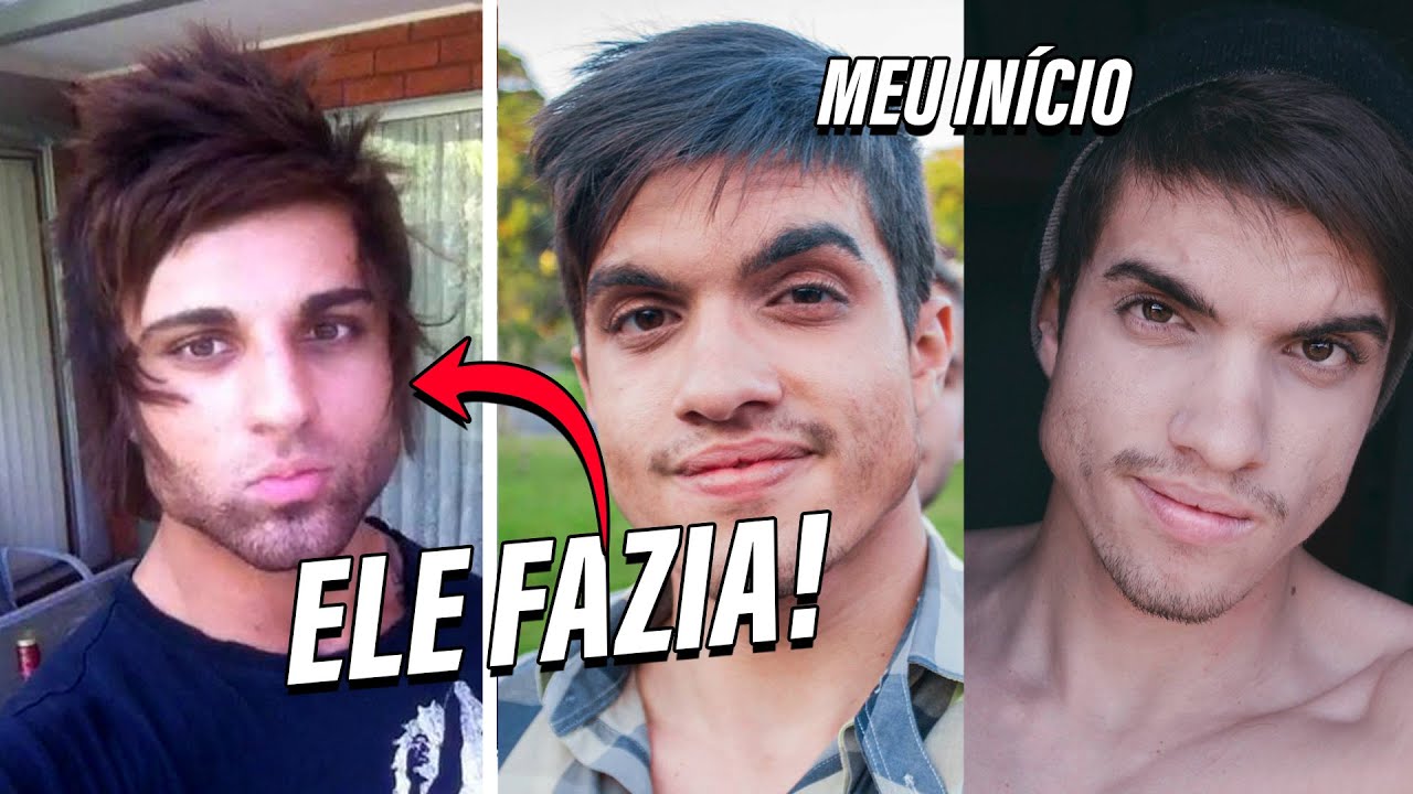 Desmistificando o Mewing: O que é? Realmente funciona?