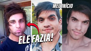 Mewing funciona? Como fazer mewing impacta a saúde