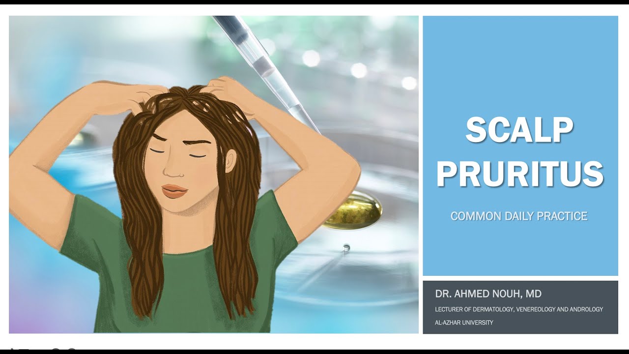 Scalp pruritus part 1