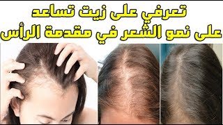 تعرفي على زيت تساعد على نمو الشعر في مقدمة الرأس | د.عماد ميزاب