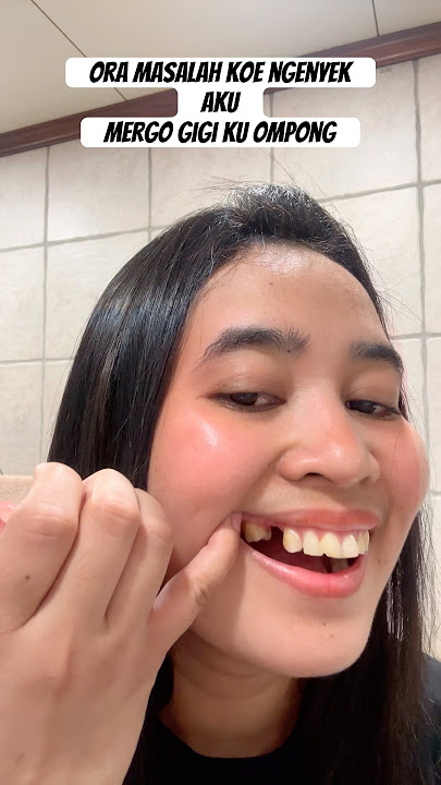 Snap on smile gigi ompong gigi palsu #shortsviral #shortsfeed #shortsvideo #snaponsmile #gigipalsu