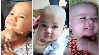 The bald head Asian Cute Baby |Aleena Kidz Show The bald head Asian Cute Baby |Aleena Kidz Show