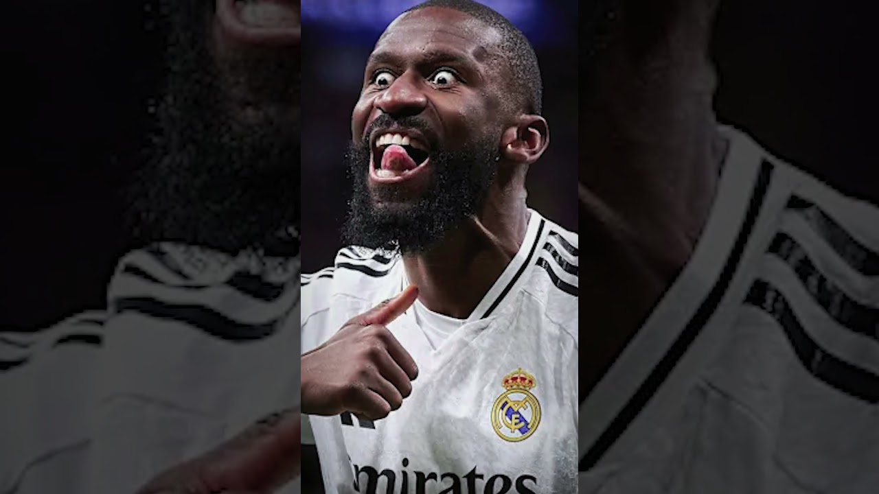 Mbappe sparkad!?🦵🤬