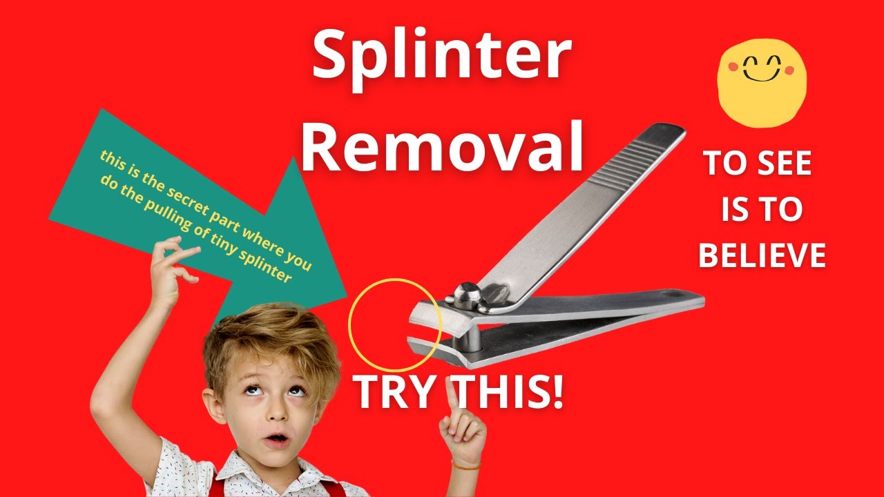 Remove Splinter Using a Nail Clipper or Nail Cutter. TRY THIS! YouTube
