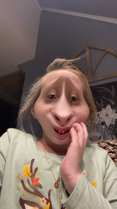 I used to be so beautiful now look at me 