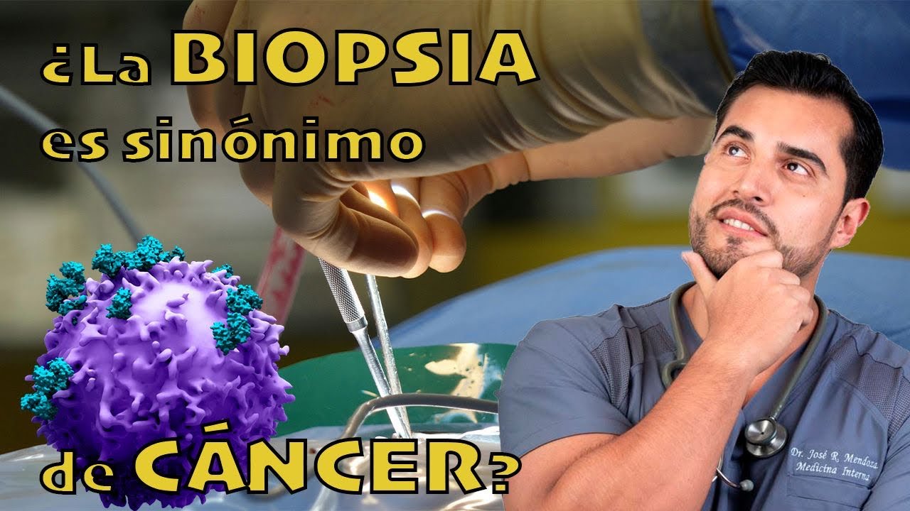 “¿Biopsia = Cáncer? La verdad que nadie te explica sobre las biopsias”