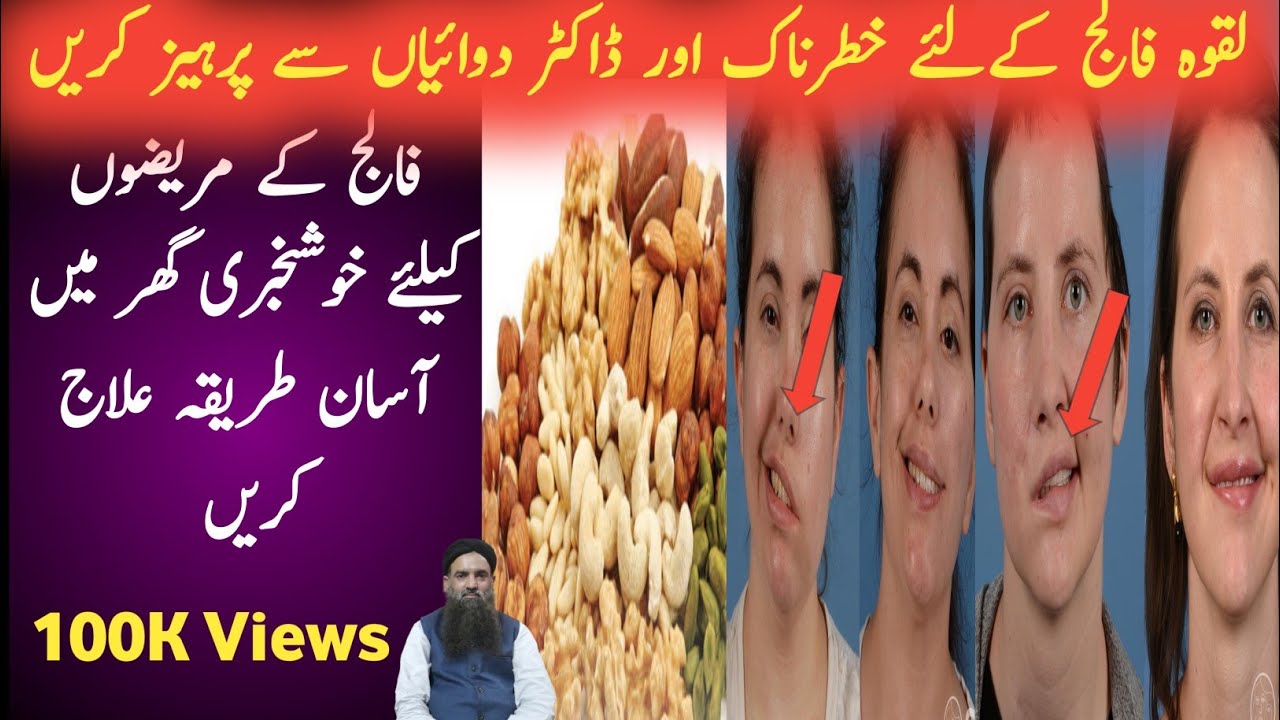 Laqwa Ka ilaj Facial Paralysis Treatment at Home in Urdu/Hindi