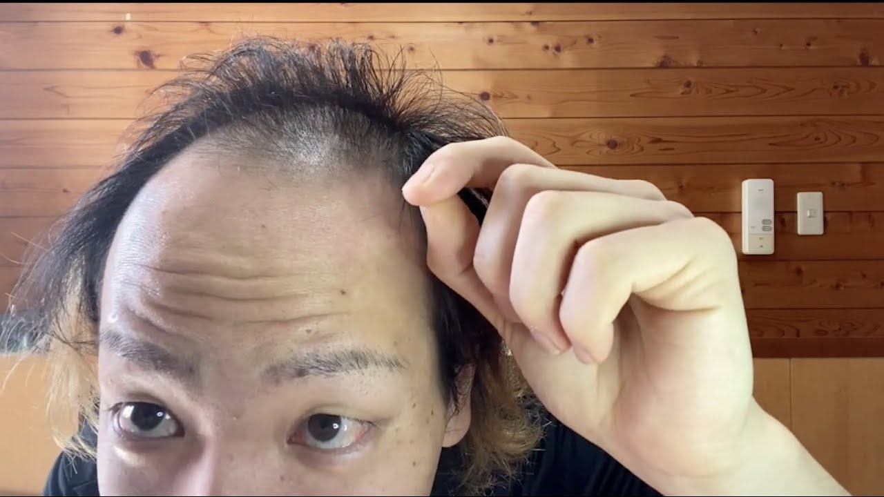 メール便なら送料無料 はげ Www Us Immigrationvisa Com