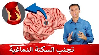 نصيحتي لتجنب الجلطة الدماغية -دكتور بيرج