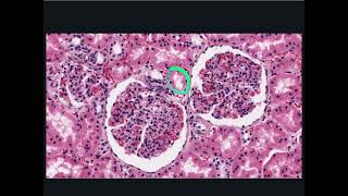 Urinary System Histology - Renal Corpuscle,  Proximal and Distal Convoluted Tubule and Macula Densa
