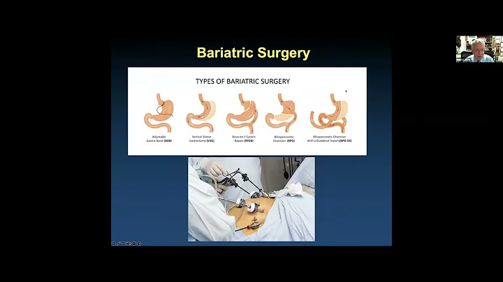 Strategies for Management of Atrial Fibrillation: State of the Art in 2023
