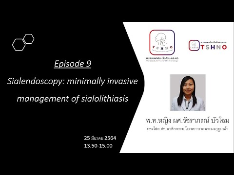 Ep 9 : Sialendoscopy: minimally invasive management of sialolithiasis