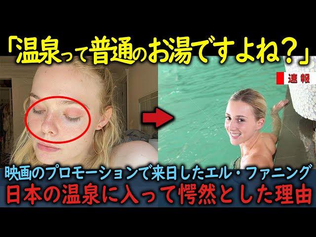 【海外の反応】「天国は日本にあったのね」アトピー性皮膚炎で悩んでいたエルファニングが日本の温泉を知ってしまった結果 class=