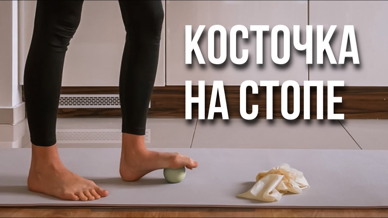 Как убрать КОСТОЧКУ НА СТОПЕ. Упражнения при Халюс вальгусе, шишка на ...