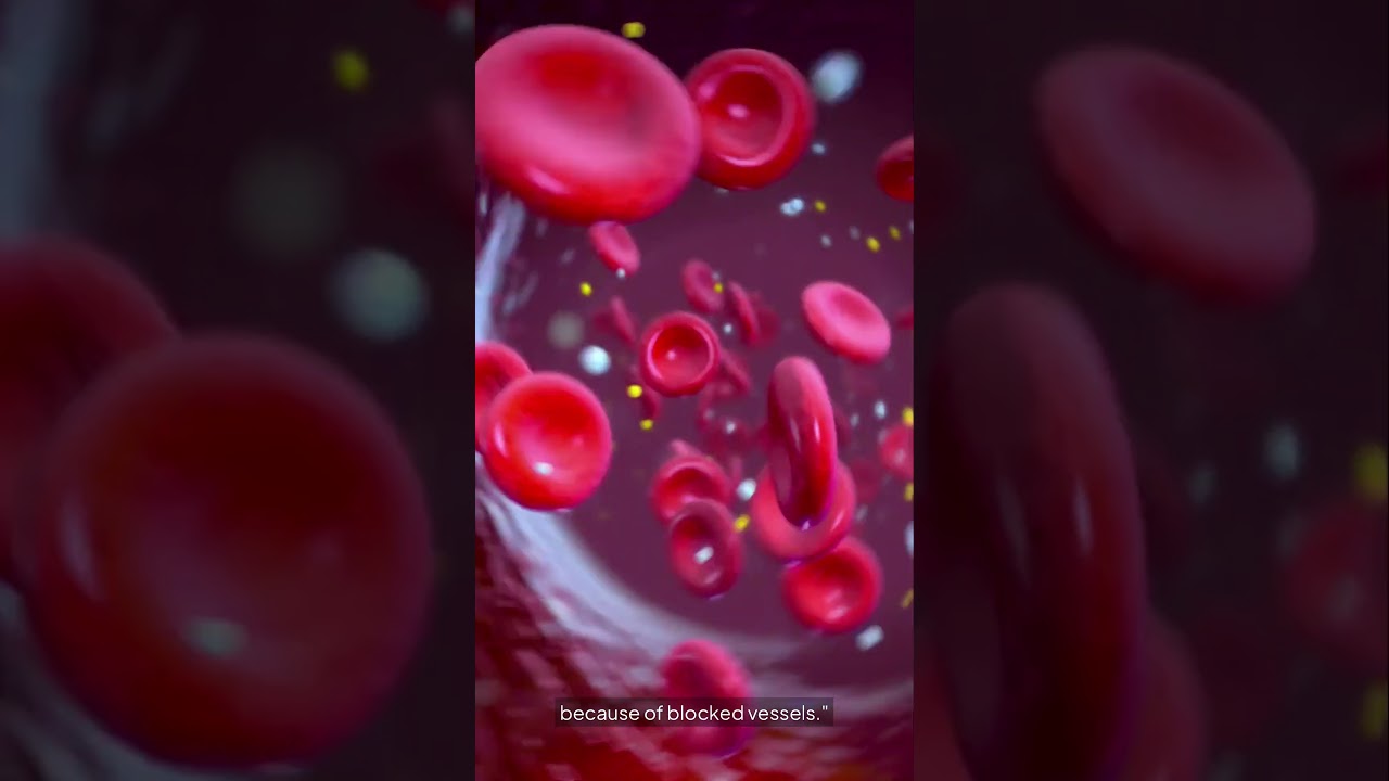 "If You Notice These 5 Symptoms – Your Arteries Might Be Clogged!"