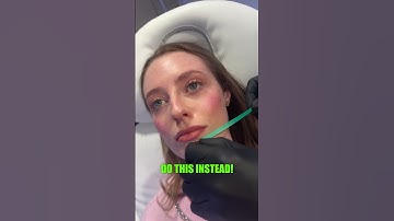 The CORRECT masseter treatment pattern