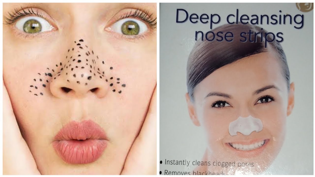 Purederm nose strips review, blackheads & whiteheads solution, how to