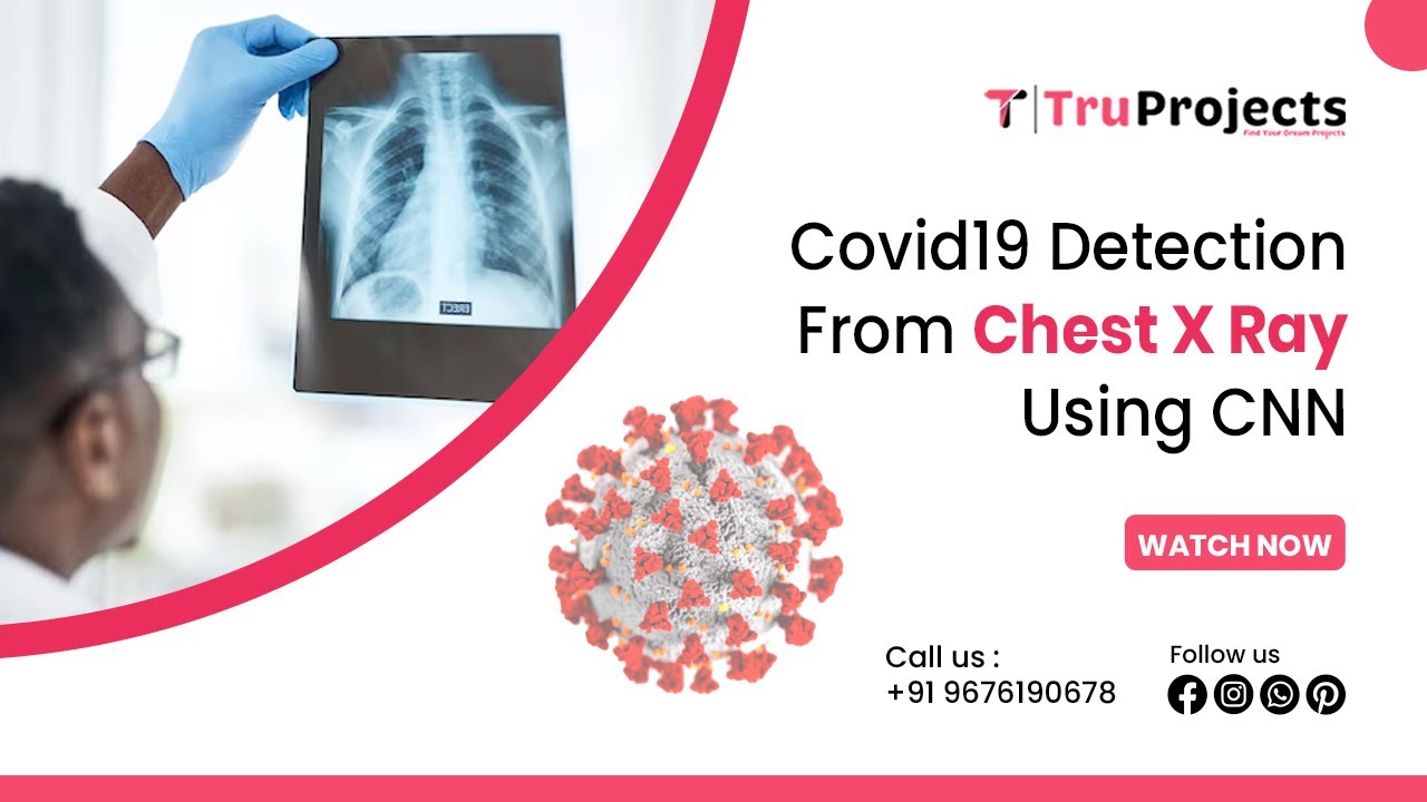 Covid19 Detection from Chest X Ray using CNN best image processing ...