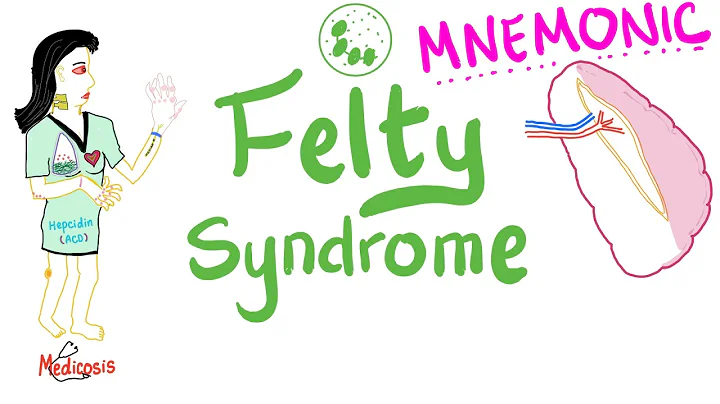 Felty Syndrome (Mnemonic) | Rheumatology