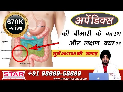 Appendix Problem Cause Sign Symptom Treatment Medicine Surgery | Best Laparoscopic Key Hole Surgery