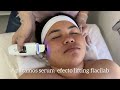 Facial flacidez | Flacilab