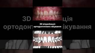 Цифрова візуалізація ортодонтичного лікування | Ортодонт | Стоматолог | Львів | Марк Харченко