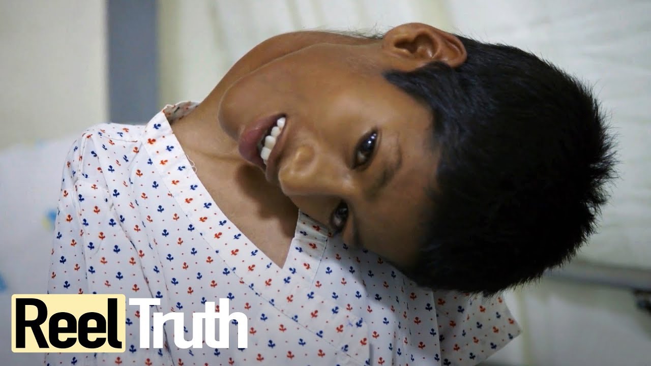 ⁣Mahendra Ahirwar: The Boy Who Sees The World Upside Down | Medical Documentary | Reel Truth
