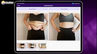 Cool Sculpting With ModMed® Plastic Surgery screenshot 4