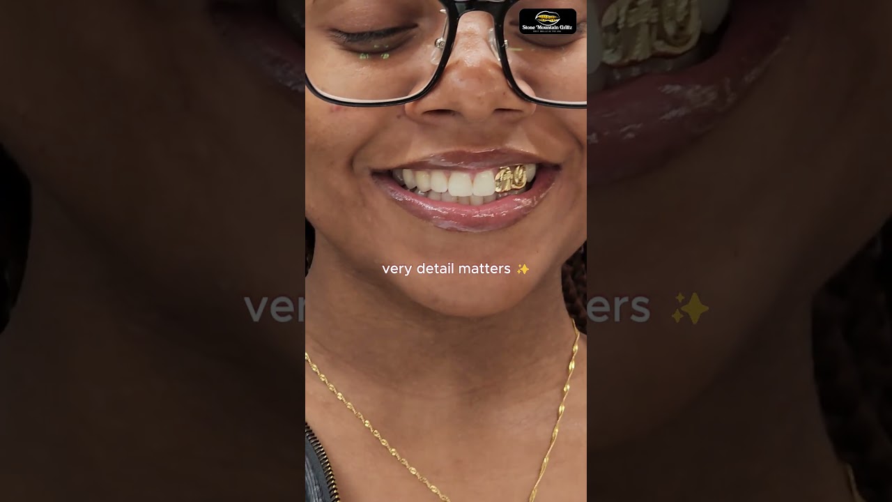 Fresh Shine, Same Day | Stone Mountain Grillz | Stone Mountain Grillz T: (678) 449-7628