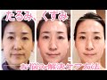 1日3分で「たるみ、くすみ改善‼︎」。むくみもスッキリして肌艶アップ！さとう式リンパケア"基本のリンパケア"