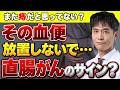 【直腸がん】「痔の出血だろう」と放置していませんか?血便・便の変化と、見逃したくない受診のタイミング!