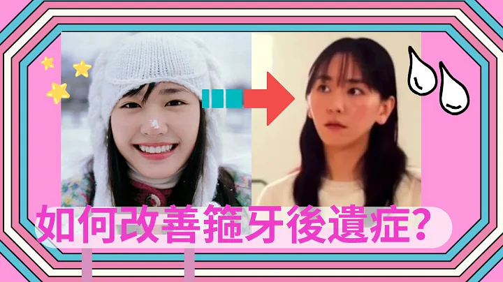 【如何改善菱形臉】新垣結衣變醜了？連新垣結衣也逃不過的箍牙後遺症！如何透過臉部運動丶髮型和化妝改善牙套臉？醜女要掙扎EP.3 - 天天要聞