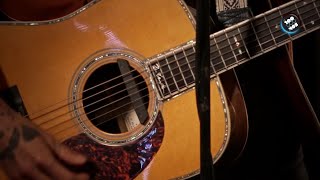 Diazepam (Leiva, acústico)