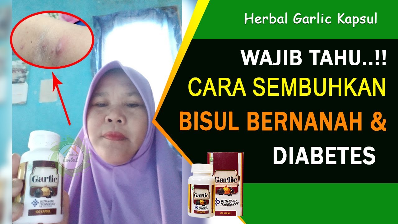 Cara Sembuhkan Bisul Bernanah dan Diabetes - Herbal Garlic Kapsul 