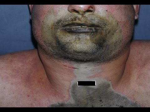 Что будет, если выпить уксус