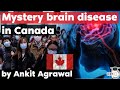 Mystery Brain Disease spreading in New Brunswick province of Canada - What we know about it so far?